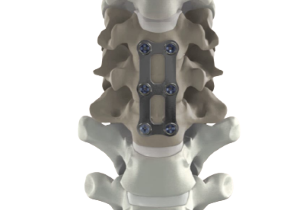 cervical spine surgery